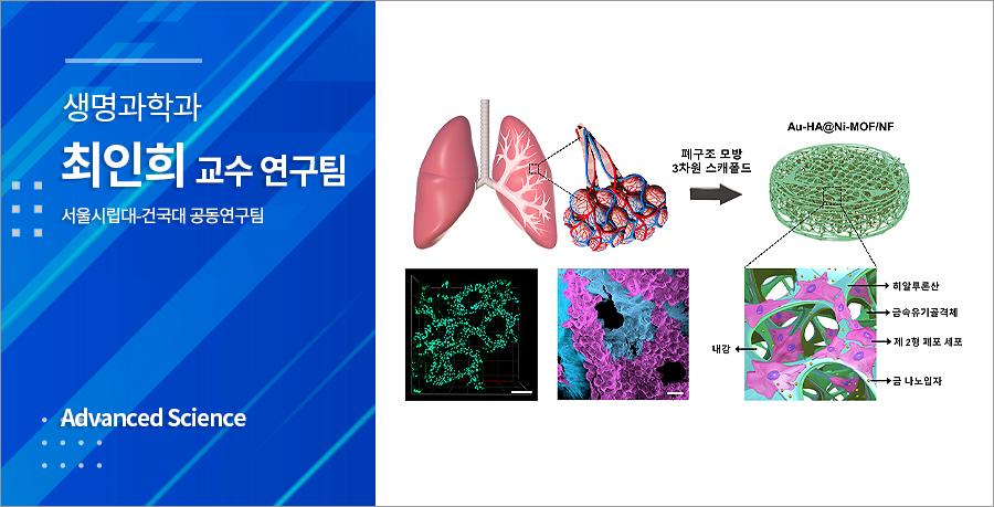 서울시립대-건국대 공동연구팀 폐 질환 독성물질 실시간 모니터링 모델 개발, 세계적 학술지 표지논문에 게재